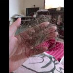 【コロナ後遺症】歩けず抜け毛、ご飯は砂利の味「大事な人のことを考えて」 声楽家女性  [ばーど★]